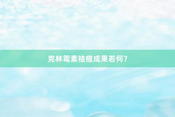 克林霉素祛痘成果若何？